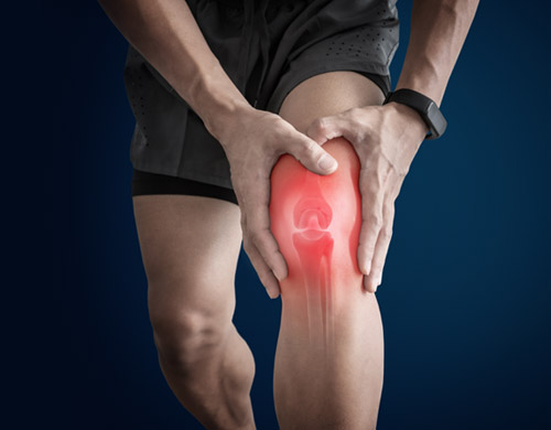 Medial collateral ligament (MCL) injury